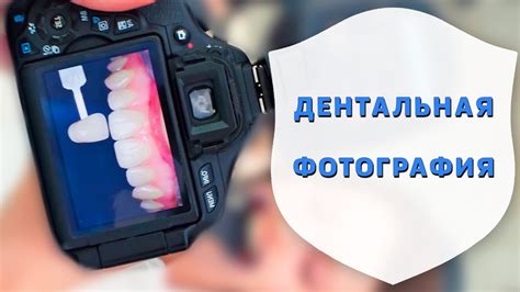Фотопротокол в стоматологии