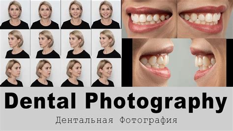Фотопротокол в стоматологии