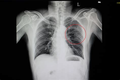 X ray перевод